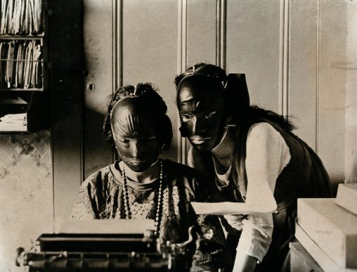 Rubber beauty masks, worn to remove wrinkles and blemishes; c. 1921.
[Wellcome Library, London; Creative Commons Attribution only licence CC BY 4.0]