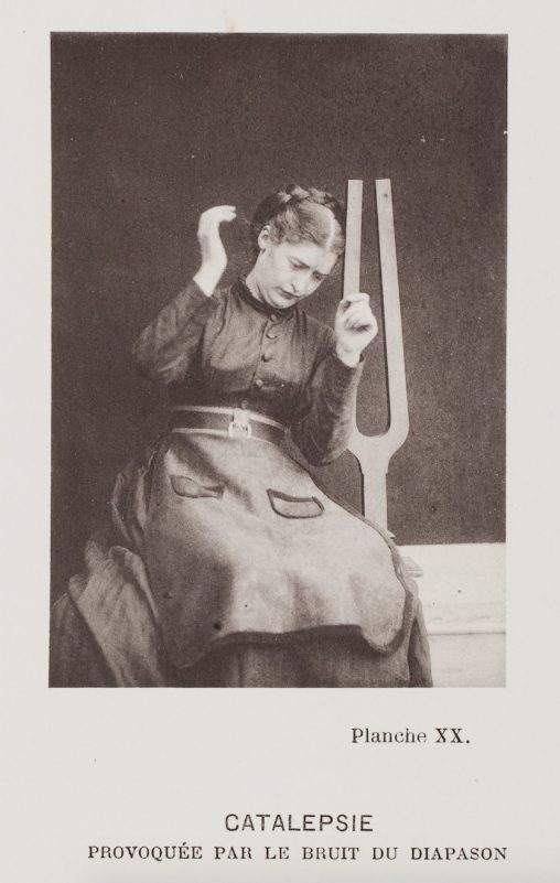 Paul Regnard
CATALEPSIE
Provoquée par le bruit du diapason
Planche XX
Iconographie photographique de la Salpêtrière vol. 3 (Paris, Progrès médical, 1880)